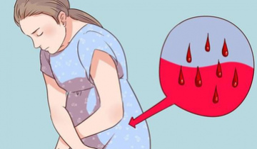 Можно ли сохранить беременность при кровотечении