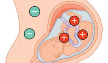Резус-конфликт во время беременности