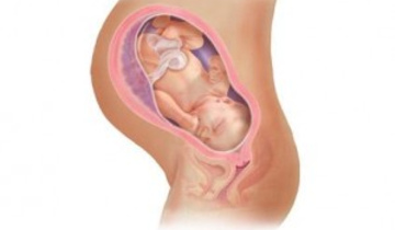 Зашивание шейки матки при беременности